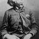 Image for article titled Did Joseph Merrick, known as "elephant man," have Proteus Syndrome?